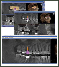 3-D CT IMAGING 3-D CT Imaging