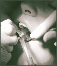 Oral Pathology Oral Pathology