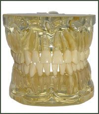 Preprosthetic Surgery Preprosthetic Surgery